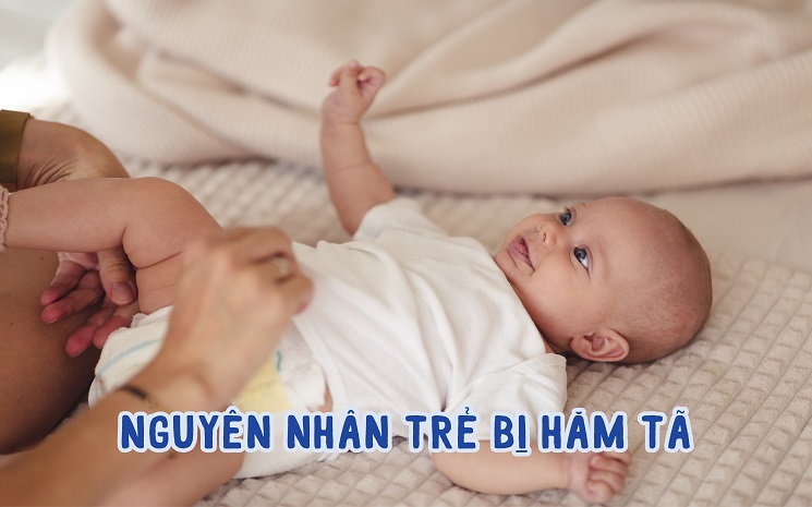 TOP 5 loại bỉm chống hăm cho bé tốt nhất hiện nay